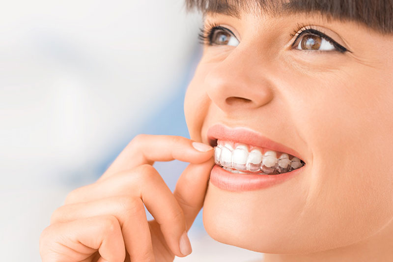 Dental Treatments in Mandeville